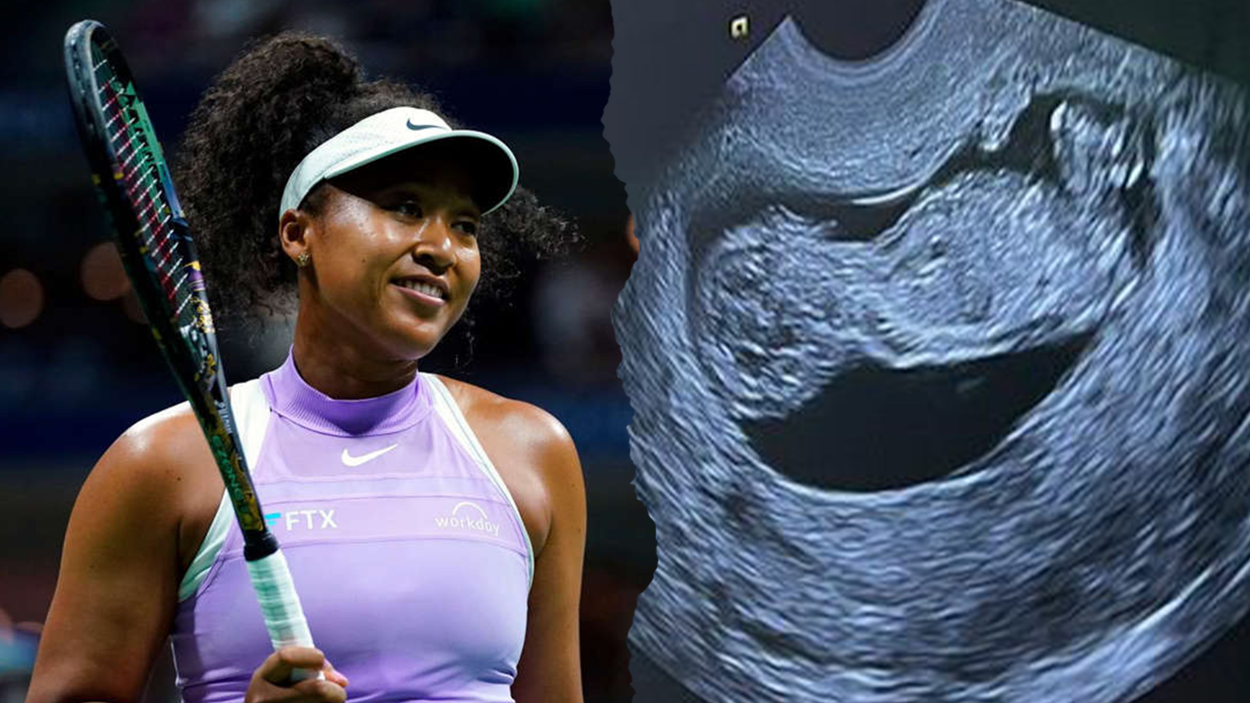 Tennis Star Naomi Osaka Is Pregnant