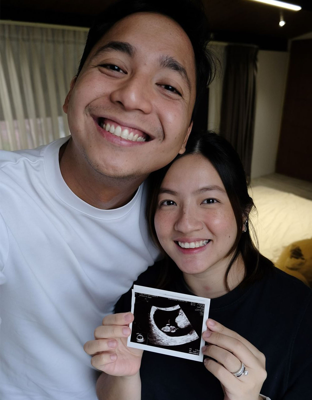 Joyce Ching revealing the sonogram of her first baby